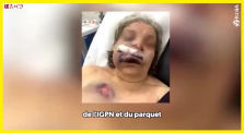 Castaner Infox sur France Inter : Zineb Redouane a reçu un tir tendu de grenade lacrymogène à la tête ! by AKINA